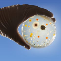 gloved hand holding petri dish against a bright light on a blue background; the dish has lots of bacterial or fungal colonies growing on it