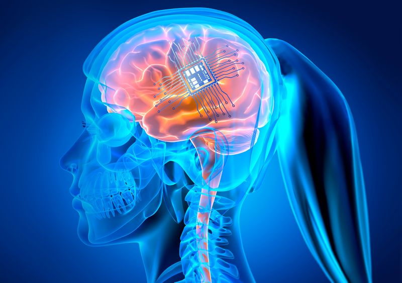 3d rendered image of side profile X-ray of female head with ponytail, the brain is shown in shades of orange and there is an electrode array attached to its surface