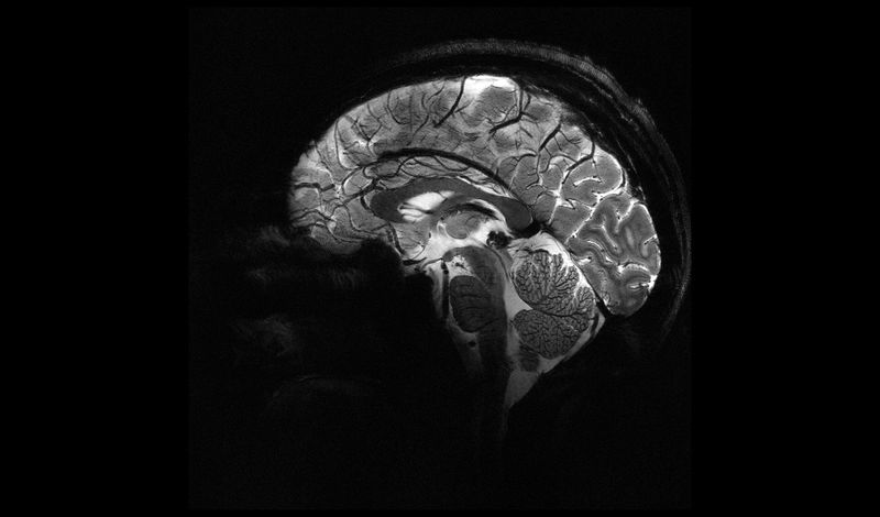 sagittal view of human brain taken using 11.7 tesla MRI scanner; black and white image of the brain with tissues and structures shown clearly in grayscale