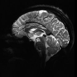 sagittal view of human brain taken using 11.7 tesla MRI scanner; black and white image of the brain with tissues and structures shown clearly in grayscale