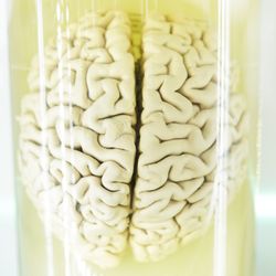 Human brain in a jar (real specimen)