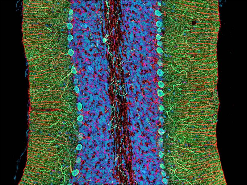 microscope image of a section of the cerebellum with the different cells labelled in colors from blue to aqua to green to pink