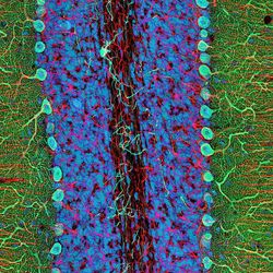 microscope image of a section of the cerebellum with the different cells labelled in colors from blue to aqua to green to pink