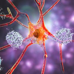 Like other recent headline-hitting drugs, the new treatment targets toxic amyloid-beta proteins in the brain.