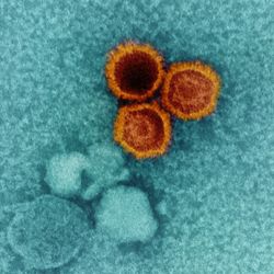 An electron micrograph showing three EBV virions in red-orange against a teal-blue background