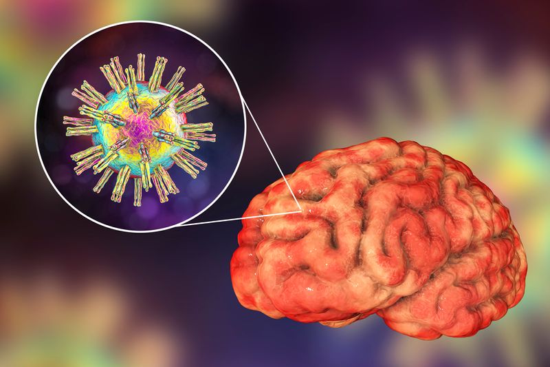 3D illustration of a human brain with a zoomed in snapshot showing a 3D representation of a herpes virus particle