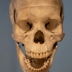 skull