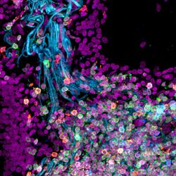 microscope image of human lung tissue with cells labelled in colours from purple to blue to turquoise and pink