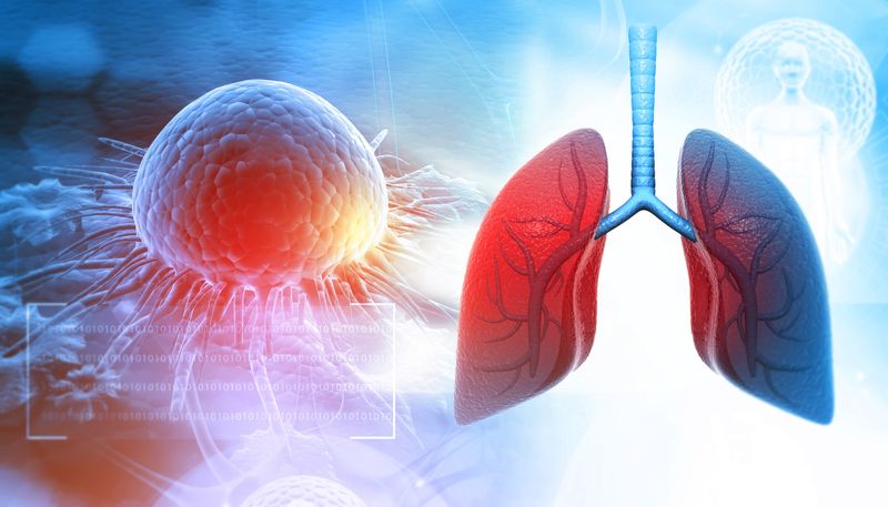 3D rendered image of human lungs on the right with a representation of a cancerous tumor on the left