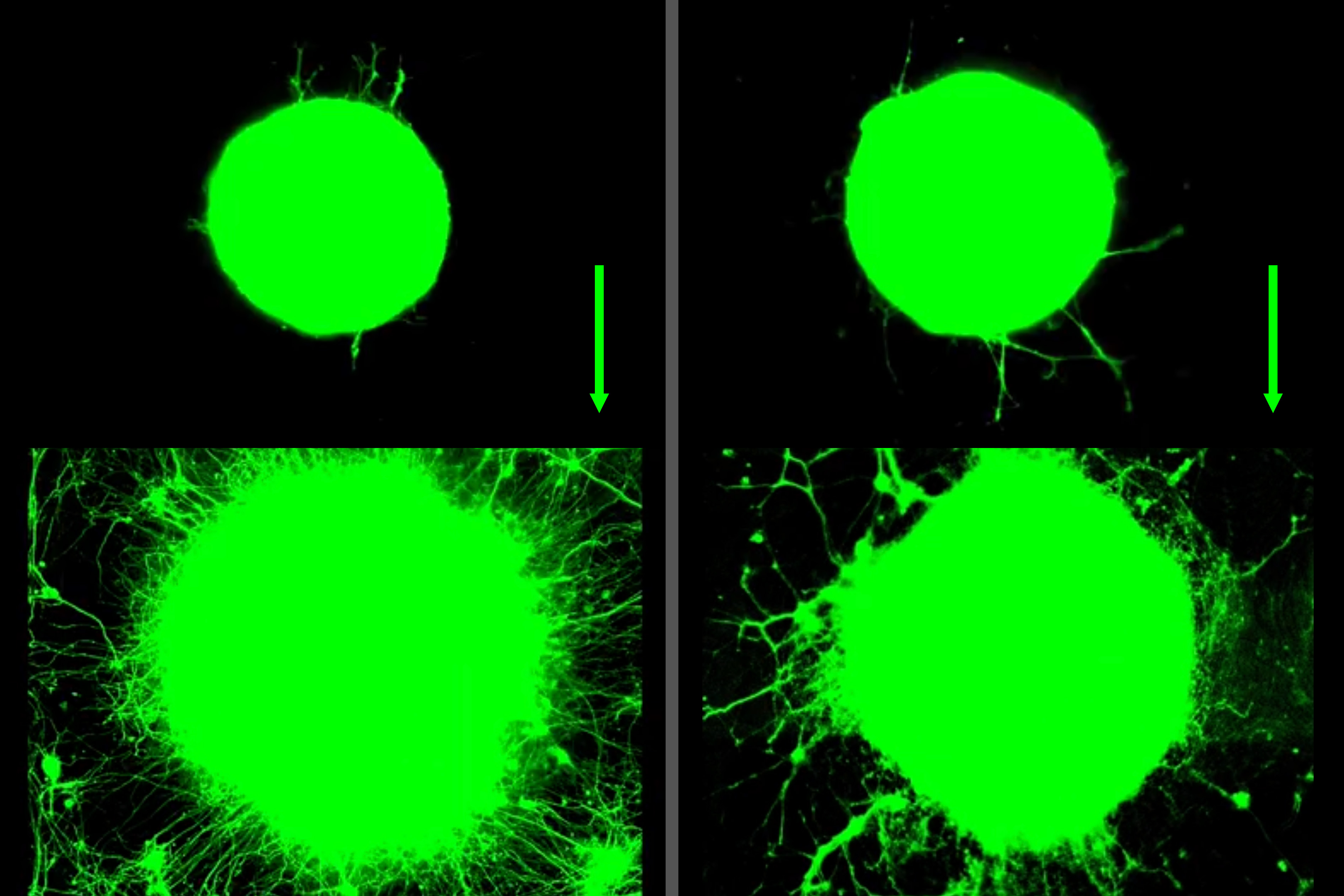 MIT scientists find that motor neuron growth increased significantly over 5 days in response to biochemical (left) and mechanical (right) signals related to exercise. The green ball represents cluster of neurons that grow outward in long tails, or axons. 