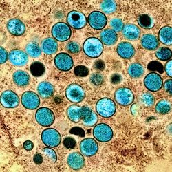 colorized transmission electron microscopic image of mpox virus particles (teal), which were found within an infected cell (brown), having been cultured in the laboratory. 