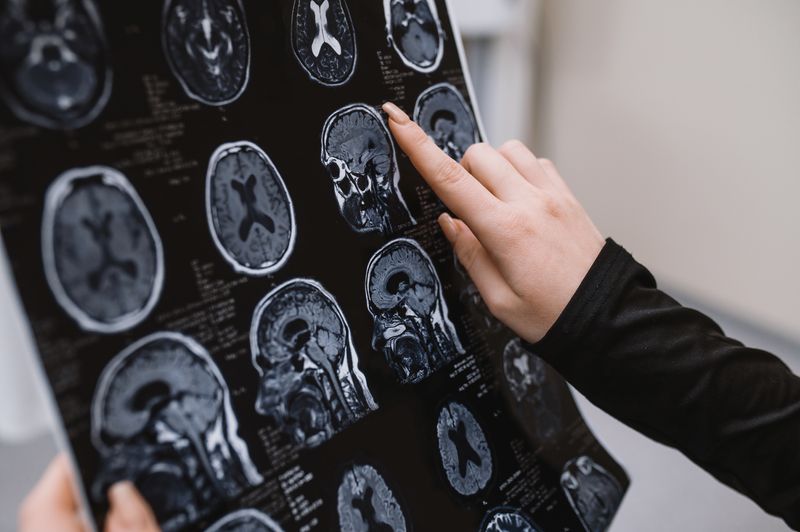 hands holding sheet of MRI scan images, with finger pointing towards one image