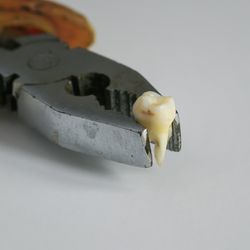 tooth held between pliers