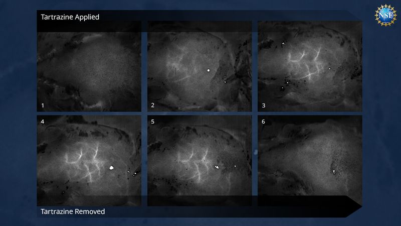 Time-lapse images of blood vessels in the brain just beneath the skull of a sedated mouse, revealed without any surgery, incisions, or damaging the mouse’s bone or skin. By reversibly dyeing the tissues with FD & C Yellow 5 and using a technique called laser speckle contrast imaging, Stanford University researchers observed the blood flow within this living brain.