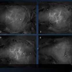 Time-lapse images of blood vessels in the brain just beneath the skull of a sedated mouse, revealed without any surgery, incisions, or damaging the mouse’s bone or skin. By reversibly dyeing the tissues with FD & C Yellow 5 and using a technique called laser speckle contrast imaging, Stanford University researchers observed the blood flow within this living brain.