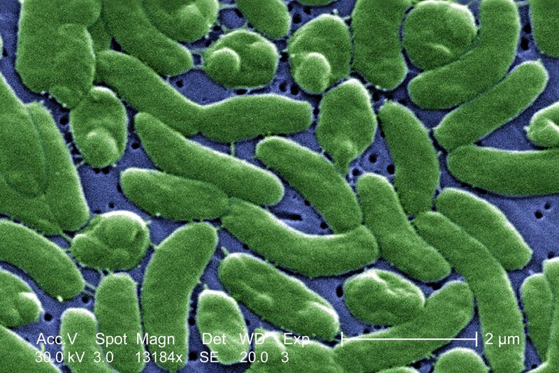 Under a high magnification of 13184X, this digitally-colorized scanning electron microscopic (SEM) image depicts a grouping of Vibrio vulnificus bacteria.