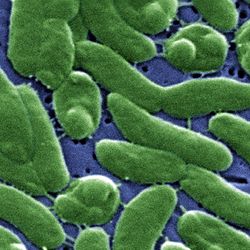 Under a high magnification of 13184X, this digitally-colorized scanning electron microscopic (SEM) image depicts a grouping of Vibrio vulnificus bacteria.