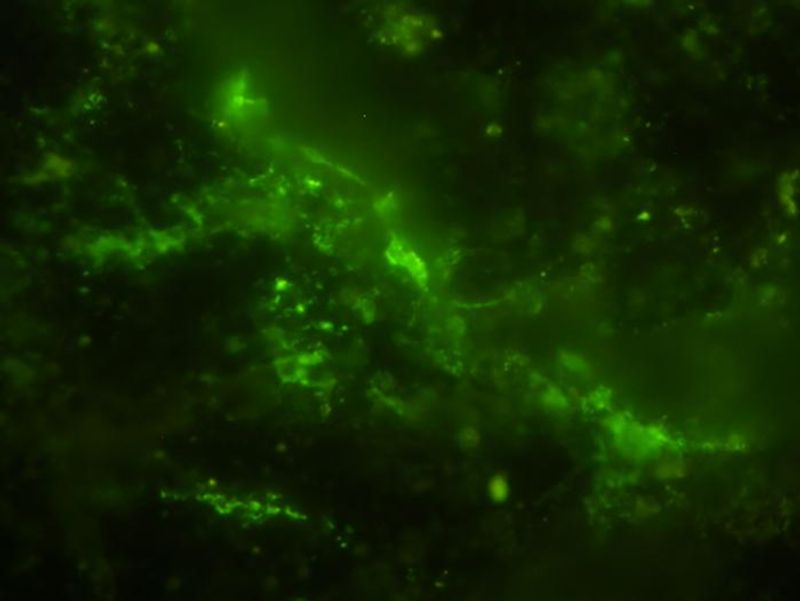 Ancient microbial cells stained green