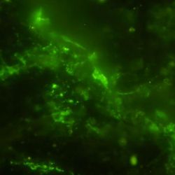 Ancient microbial cells stained green