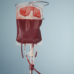 A bag of blood for transfusion.