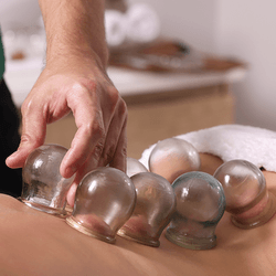 A body lies face down with clear "cups" are placed on the skin. A flame is held at the end of medical looking tweezers above the back of the person receiving the treatment.