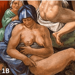 Michelangelo's depiction of The flood (1a), and a woman (1b and 1d) with a breast showing symptoms of cancer 1c. Other works show Michelangelo knew how to depict healthy breasts (1e and f)