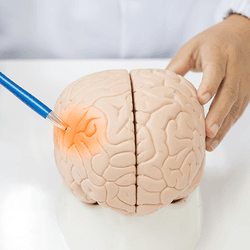 pile of small plastic particles on the left, closeup of 3D model of human brain on the right with scientist using pen to indicate a highlighted red patch