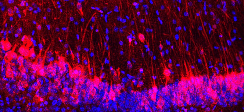 close-up of neurons in the mouse hippocampal labelled in red and blue