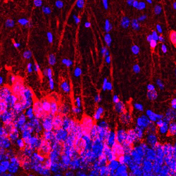 close-up of neurons in the mouse hippocampal labelled in red and blue