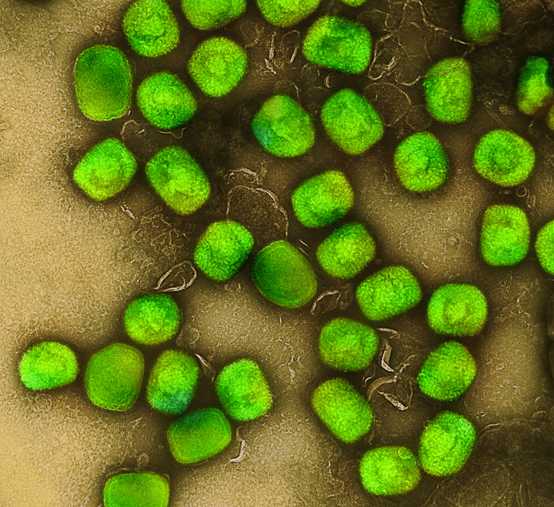 colorized transmission electron microscopic image of mpox virus particles (green) that had been cultivated and purified from cell culture. 