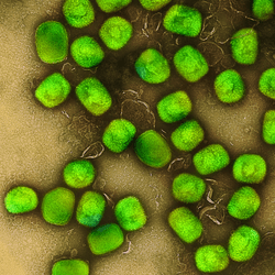 colorized transmission electron microscopic image of mpox virus particles (green) that had been cultivated and purified from cell culture. 