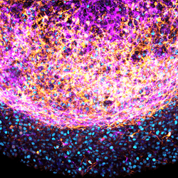 A zoom-in image of a part of a human fetal brain organoid. Stem cells are marked by SOX2 (cyan) and neuronal cells (TUJ1) are color coded from pink to yellow based on depth.