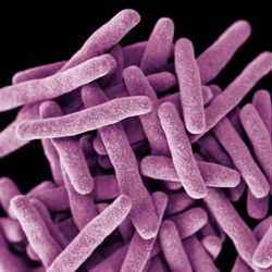 This illustration depicts a three-dimensional (3D) computer-generated image of a cluster of rod-shaped, drug-resistant, Mycobacterium tuberculosis bacteria, the pathogen responsible for causing the disease tuberculosis (TB). The artistic recreation was based upon scanning electron microscopic (SEM) imagery.