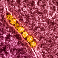 microscope image of West Nile virus, colored yellow (left); close up of Female Culex restuans mosquito (right)