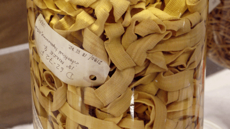 a tapeworm taken from a minke whale in a jar, it looks like lots of ribbons or noodles overlapping